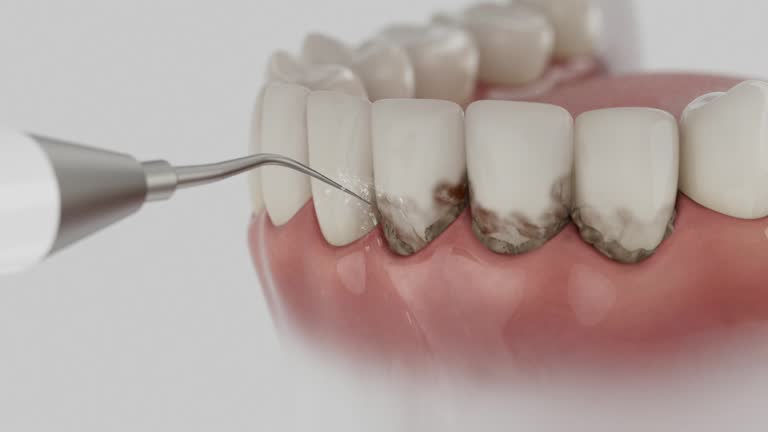 Reliable Dental contractor in Newfoundland, NJ by Dentist Open Now